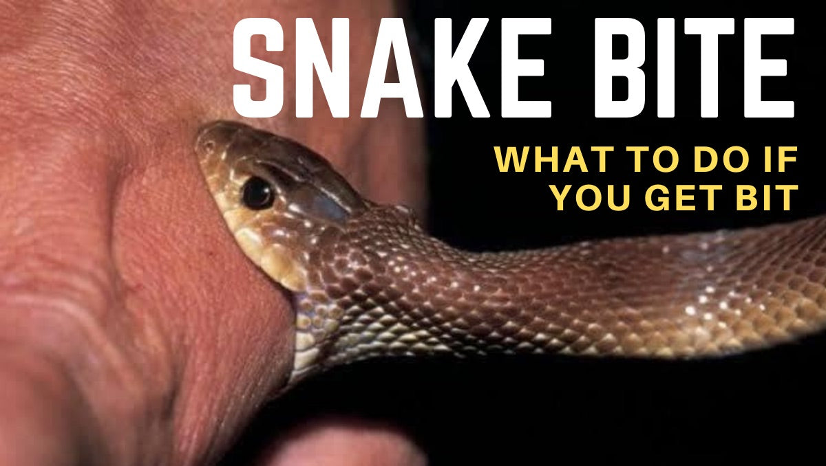 What to do if you've been bitten by a snake