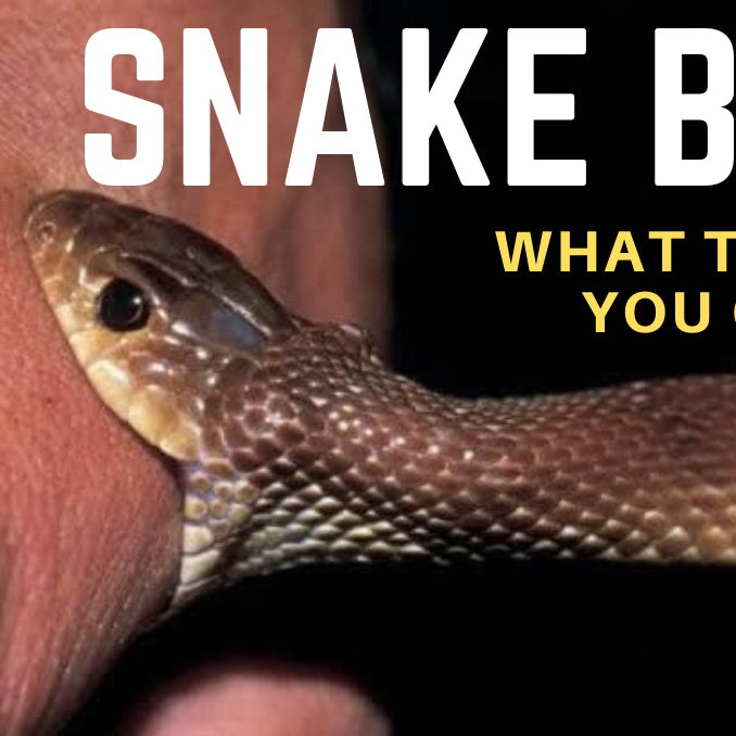 What to do if you've been bitten by a snake